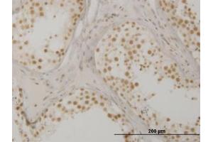 Image no. 1 for anti-Oxidative-Stress Responsive 1 (OXSR1) (AA 351-450) antibody (ABIN599103) (OXSR1 antibody  (AA 351-450))