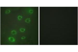 Immunofluorescence analysis of HuvEc cells, using PTX3 Antibody. (PTX3 antibody  (AA 1-50))