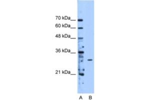 Western Blotting (WB) image for anti-Methyltransferase Like 1 (METTL1) antibody (ABIN2463199) (METTL1 antibody)