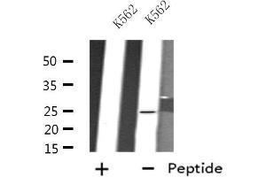 Western blot analysis of extracts from K562 cells, using FEV antibody. (FEV antibody  (N-Term))