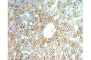 Rat liver tissue was stained by rabbit Anti-ABCB6 (260-301) (Human, Mouse ) Serum (ENPP2 antibody  (AA 369-391))
