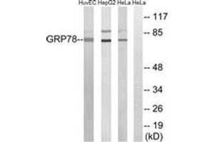 Western blot analysis of extracts from HuvEc/HepG2/HeLa cells, using GRP78 Antibody. (GRP78 antibody  (AA 605-654))