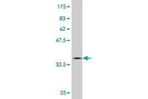 Western Blot detection against Immunogen (36. (CNOT2 antibody  (AA 441-540))