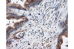 Immunohistochemical staining of paraffin-embedded Kidney tissue using anti-LIPG mouse monoclonal antibody. (LIPG antibody)