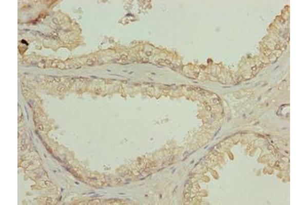 N4BP2L2 antibody  (AA 1-300)