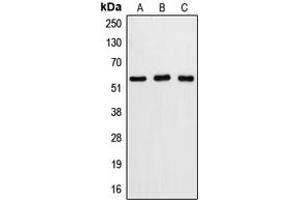 Western blot analysis of Caspase 8 expression in DLD (A), mouse liver (B), Raw264. (Caspase 8 antibody  (Center))