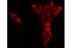 ABIN6268950 staining HeLa? (Dematin antibody  (C-Term))