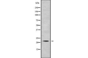 Western blot analysis of KCNMB1 using COS7 whole cell lysates (KCNMB1 antibody)