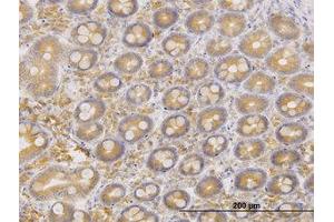 Image no. 1 for anti-ERO1-Like Protein alpha (ERO1L) (AA 90-179) antibody (ABIN599232) (ERO1L antibody  (AA 90-179))