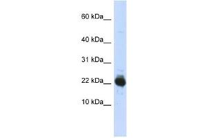 UBE2L3 antibody used at 1 ug/ml to detect target protein. (UBE2L3 antibody  (Middle Region))