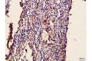 Formalin-fixed and paraffin embedded chicken intestine labeled with Anti-Newcastle disease virus Polyclonal Antibody, Unconjugated  at 1:200 followed by conjugation to the secondary antibody and DAB staining (Newcastle Disease Virus antibody)