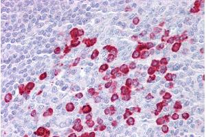 Immunohistochemistry with Tonsil tissue at an antibody concentration of 5µg/ml using anti-DAK antibody (ARP55278_P050)