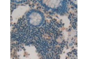 Figure. (ULBP2 antibody  (AA 26-246))