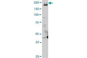 TLN1 monoclonal antibody (M06), clone 2E10. (TLN1 antibody  (AA 1052-1149))