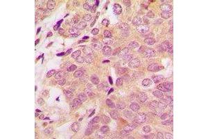 Immunohistochemistry (IHC) image for anti-S100 Calcium Binding Protein A11 (S100A11) antibody (ABIN7308300) (S100A11 antibody)