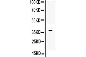 Western blot analysis of DKK1 using anti-DKK1 antibody (ABIN6719383).