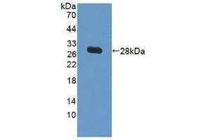 Detection of Recombinant VCAM1, Human using Polyclonal Antibody to Vascular Cell Adhesion Molecule 1 (VCAM1) (VCAM1 antibody  (AA 109-318))