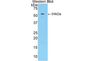 Detection of Recombinant TFF3, Porcine using Polyclonal Antibody to Trefoil Factor 3 (TFF3) (TFF3 antibody  (AA 22-80))