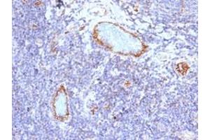 Immunohistochemical staining (Formalin-fixed paraffin-embedded sections) of human tonsil with VWF monoclonal antibody, clone VWF/1465 . (VWF antibody  (AA 1815-1939))
