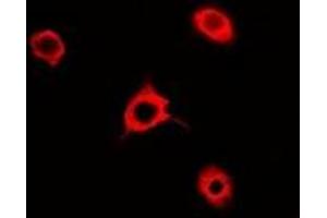 Immunofluorescent analysis of Rac 1 staining in A549 cells. (RAC1 antibody)