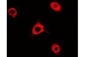 Immunofluorescent analysis of Rac 1 staining in A549 cells. (RAC1 antibody)