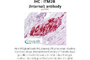 Image no. 1 for anti-Integral Membrane Protein 2B (ITM2B) (Internal Region) antibody (ABIN1736083) (ITM2B antibody  (Internal Region))
