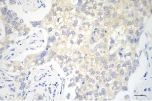 anti-Mechanistic Target of Rapamycin (serine/threonine Kinase) (mTOR) (pSer2448) antibody