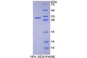 SDS-PAGE (SDS) image for Protein Kinase D1 (PRKD1) (AA 651-876) protein (His tag) (ABIN2126510) (PKC mu Protein (AA 651-876) (His tag))