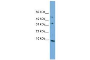 Image no. 1 for anti-Chromosome 16 Open Reading Frame 61 (C16orf61) (C-Term) antibody (ABIN6744182) (C16orf61 antibody  (C-Term))