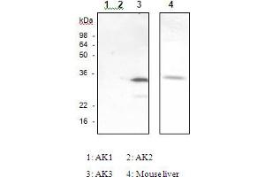 Western Blotting (WB) image for anti-Adenylate Kinase 3 (AK3) antibody (ABIN165376)