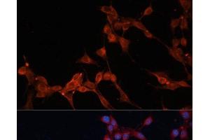 Immunofluorescence analysis of NIH/3T3 cells using SLC25A38 Polyclonal Antibody at dilution of 1:100. (SLC25A38 antibody)