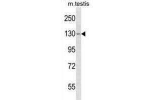 Western Blotting (WB) image for anti-TBC1 Domain Family, Member 2 (TBC1D2) antibody (ABIN5019936)