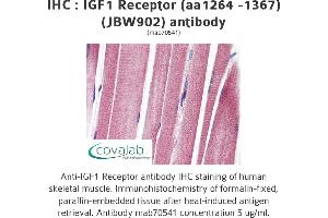 Image no. 1 for anti-Insulin-Like Growth Factor 1 Receptor (IGF1R) (AA 1264-1367) antibody (ABIN1723400) (IGF1R antibody  (AA 1264-1367))