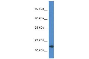 WB Suggested Anti-Rnf122 Antibody   Titration: 1. (RNF122 antibody  (Middle Region))