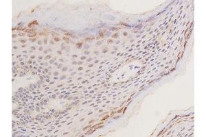 Immunohistochemistry (IHC) image for anti-Tumor Protein P53 (TP53) (pSer392) antibody (ABIN6256312)