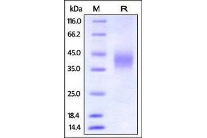 Mouse FCGR3A / CD16a, His Tag on SDS-PAGE under reducing (R) condition. (FCGR3A Protein (AA 32-215) (His tag))
