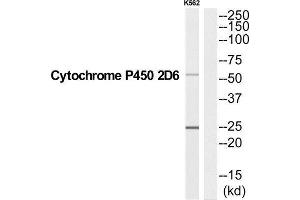Western Blotting (WB) image for anti-Cytochrome P450, Family 2, Subfamily D, Polypeptide 6 (CYP2D6) (C-Term) antibody (ABIN1852641) (CYP2D6 antibody  (C-Term))