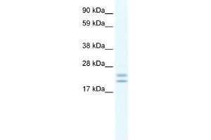 WB Suggested Anti-Tppp Antibody Titration:  0.