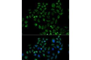 Immunofluorescence analysis of HeLa cells using FABP2 Polyclonal Antibody (FABP2 antibody)