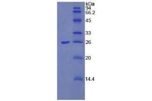 SDS-PAGE (SDS) image for Pentraxin 3 (PTX3) (AA 183-381) protein (ABIN7405523)