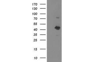 HEK293T cells were transfected with the pCMV6-ENTRY control (Left lane) or pCMV6-ENTRY OBFC1 (Right lane) cDNA for 48 hrs and lysed. (OBFC1 antibody)