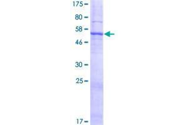 SLC25A38 Protein (AA 1-304) (GST tag)