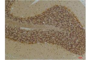 Immunohistochemical analysis of paraffin-embedded Human BrainTissue using KCNN2(SK2) Rabbit pAb diluted at 1:200. (KCNN2 antibody)