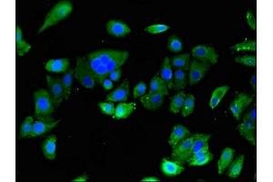 Immunofluorescent analysis of HepG2 cells using ABIN7144771 at dilution of 1:100 and Alexa Fluor 488-congugated AffiniPure Goat Anti-Rabbit IgG(H+L)