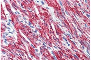 Immunohistochemistry (Paraffin-embedded Sections) (IHC (p)) image for anti-Polyribonucleotide Nucleotidyltransferase 1 (PNPT1) (AA 489-538) antibody (ABIN6741592)