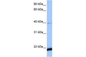 Western Blotting (WB) image for anti-HBS1-Like (HBS1L) antibody (ABIN2463501)