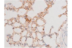 Immunohistochemistry (IHC) image for anti-GATA Binding Protein 4 (GATA4) (pSer262) antibody (ABIN6256227)
