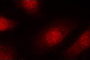 Immunofluorescence staining of methanol-fixed Hela cells, using Phospho-RB1-S780 antibody. (Retinoblastoma 1 antibody  (pSer780))