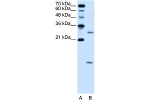 WB Suggested Anti-VMA21 Antibody Titration:  5. (VMA21 antibody  (N-Term))