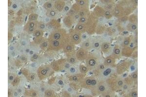 Immunohistochemistry (IHC) image for anti-Fas Ligand (TNF Superfamily, Member 6) (FASL) antibody (ABIN7439063)